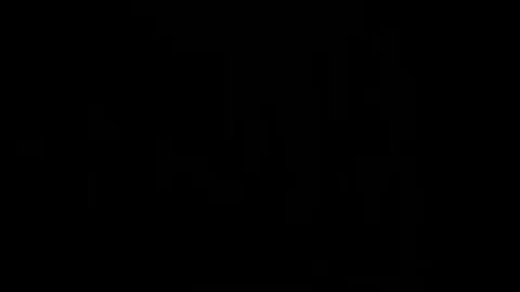 Crutches lad spoiled by CFNM divas Part 30