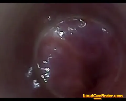 test tube cock endoscope POV urethral insertion ba Part 11