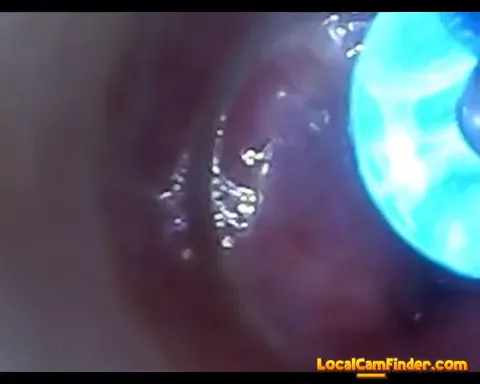 test tube cock endoscope POV urethral insertion ba Part 12