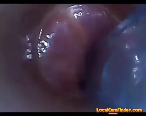 test tube cock endoscope POV urethral insertion ba Part 13