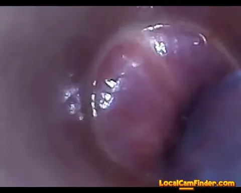 test tube cock endoscope POV urethral insertion ba Part 14