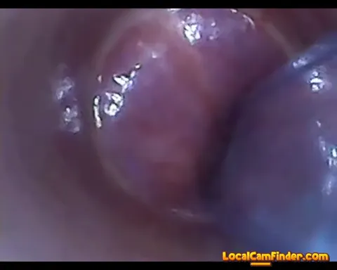 test tube cock endoscope POV urethral insertion ba Part 15