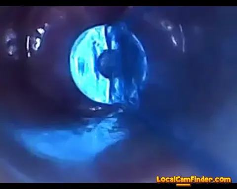 test tube cock endoscope POV urethral insertion ba Part 16