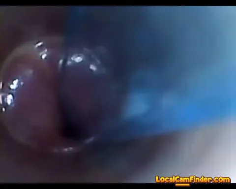 test tube cock endoscope POV urethral insertion ba Part 17