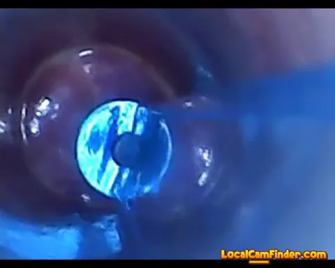 test tube cock endoscope POV urethral insertion ba Part 18