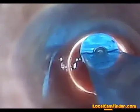 test tube cock endoscope POV urethral insertion ba Part 19
