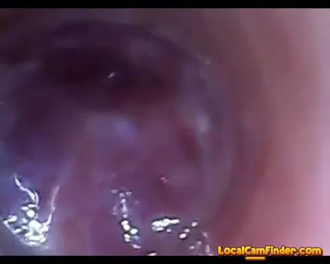 test tube cock endoscope POV urethral insertion ba Part 2