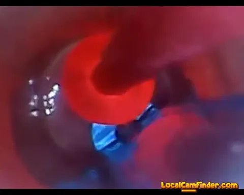 test tube cock endoscope POV urethral insertion ba Part 20
