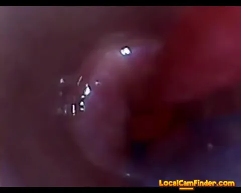 test tube cock endoscope POV urethral insertion ba Part 21