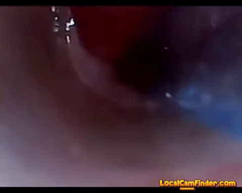 test tube cock endoscope POV urethral insertion ba Part 22