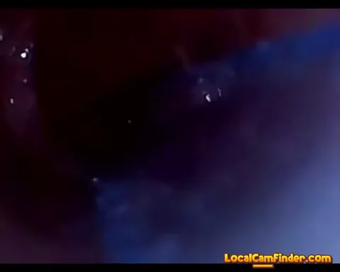 test tube cock endoscope POV urethral insertion ba Part 23