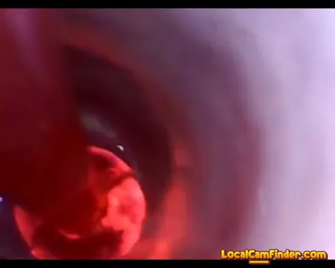 test tube cock endoscope POV urethral insertion ba Part 26