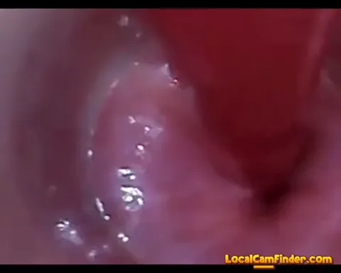 test tube cock endoscope POV urethral insertion ba Part 27