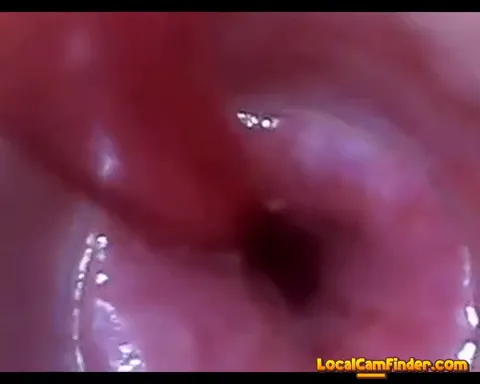 test tube cock endoscope POV urethral insertion ba Part 28