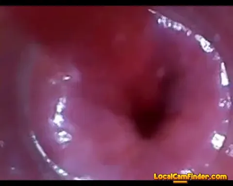 test tube cock endoscope POV urethral insertion ba Part 29