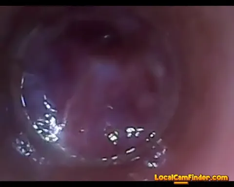 test tube cock endoscope POV urethral insertion ba Part 3