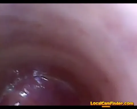 test tube cock endoscope POV urethral insertion ba Part 30