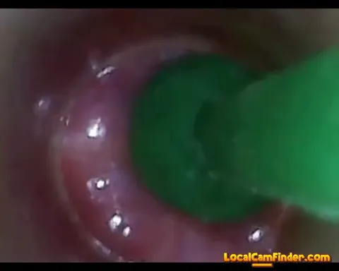 test tube cock endoscope POV urethral insertion ba Part 33