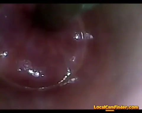 test tube cock endoscope POV urethral insertion ba Part 34