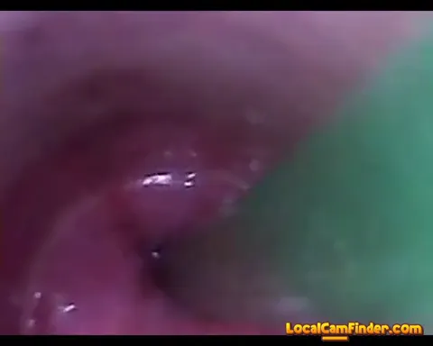 test tube cock endoscope POV urethral insertion ba Part 35
