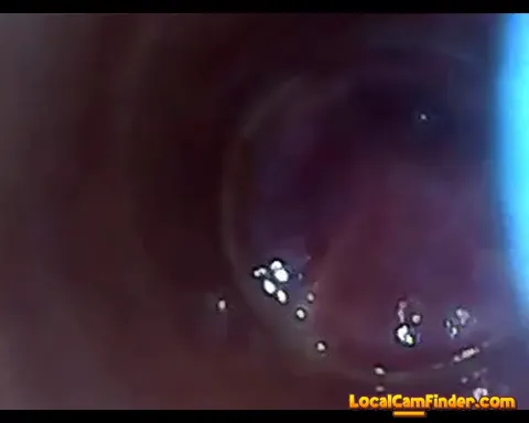 test tube cock endoscope POV urethral insertion ba Part 4