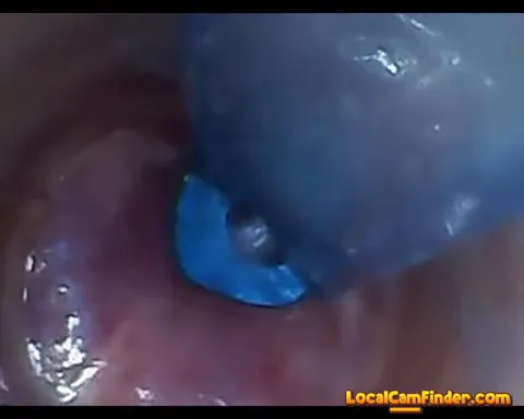 test tube cock endoscope POV urethral insertion ba Part 5