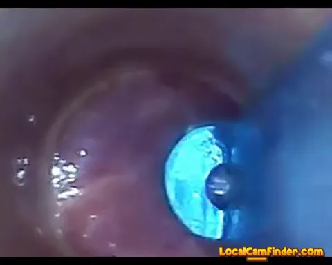 test tube cock endoscope POV urethral insertion ba Part 6